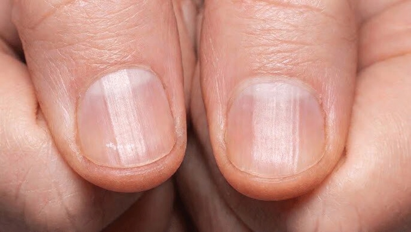 O Que Essas Estrias nas Unhas Realmente Significam? Hábitos Diários Simples para Ajudar a Manter as Unhas Mais Saudáveis