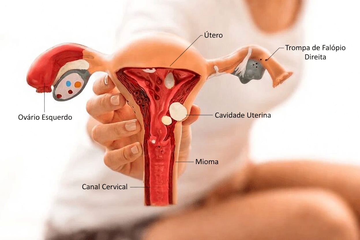 O Que Toda Mulher Deve Saber Sobre a Endometriose: Sintomas, Causas e Dicas Práticas de Estilo de Vida para Dias Melhores