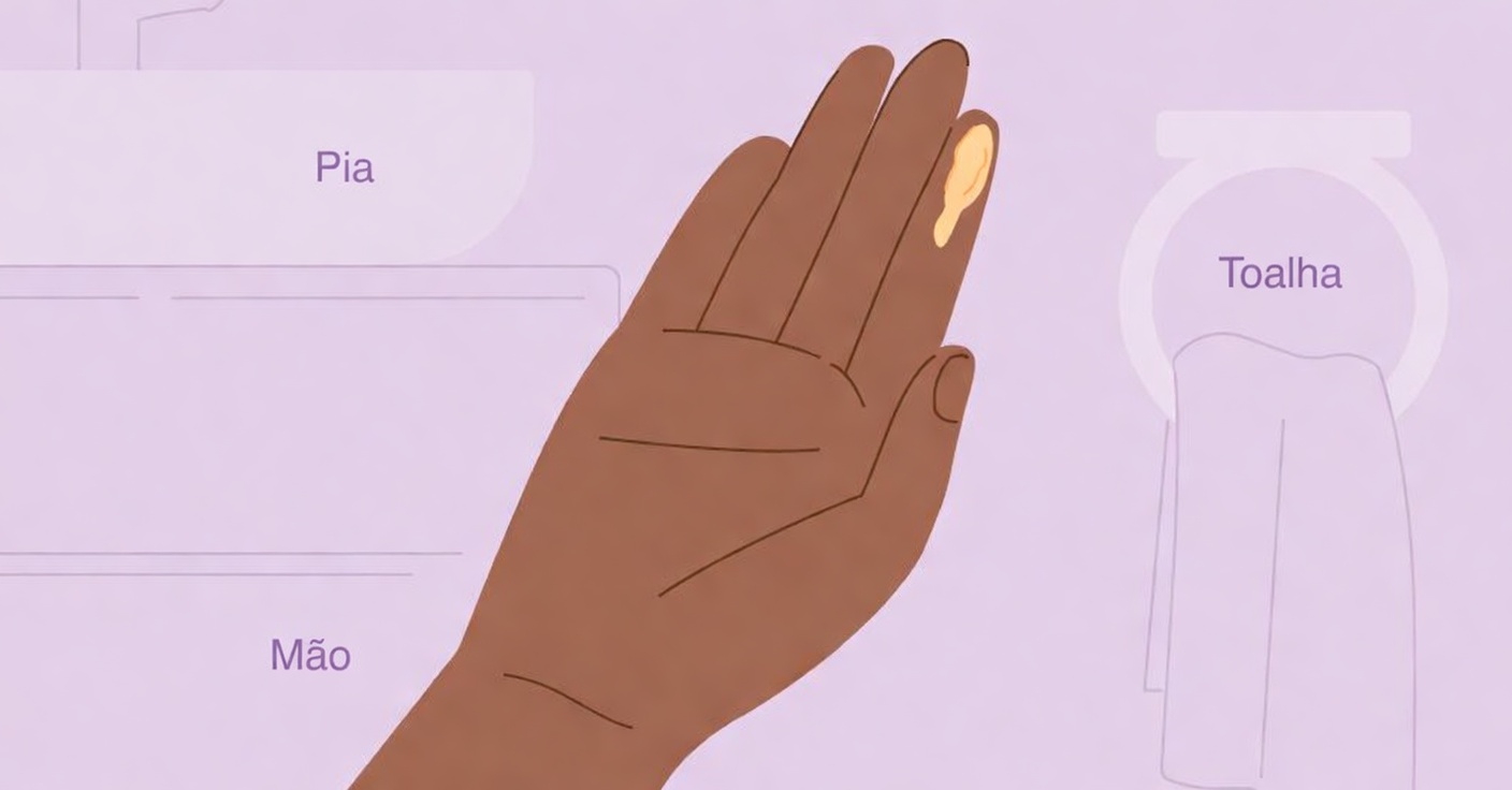 O que significa corrimento vaginal amarelo? Causas comuns e quando prestar atenção