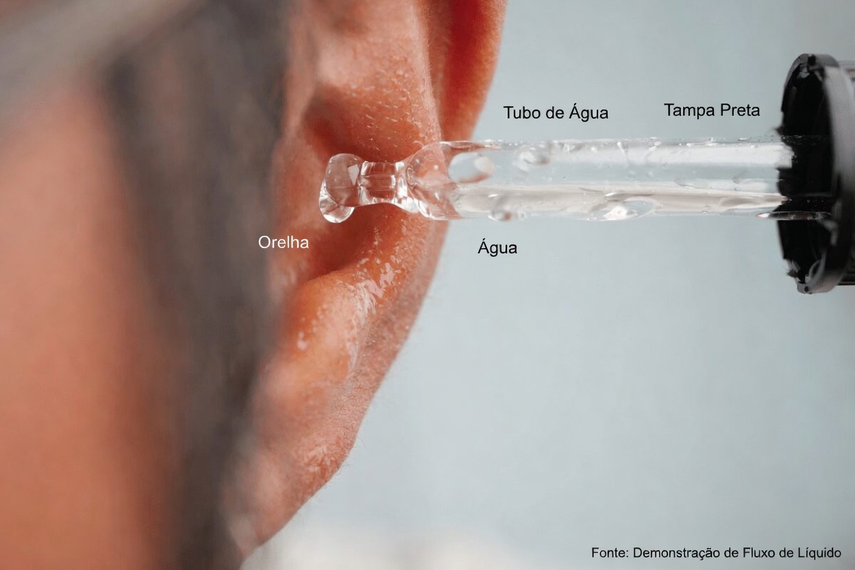 Colocar 4 Gotas de Azeite no Ouvido: Guia Simples para os Cuidados Diários com os Ouvidos