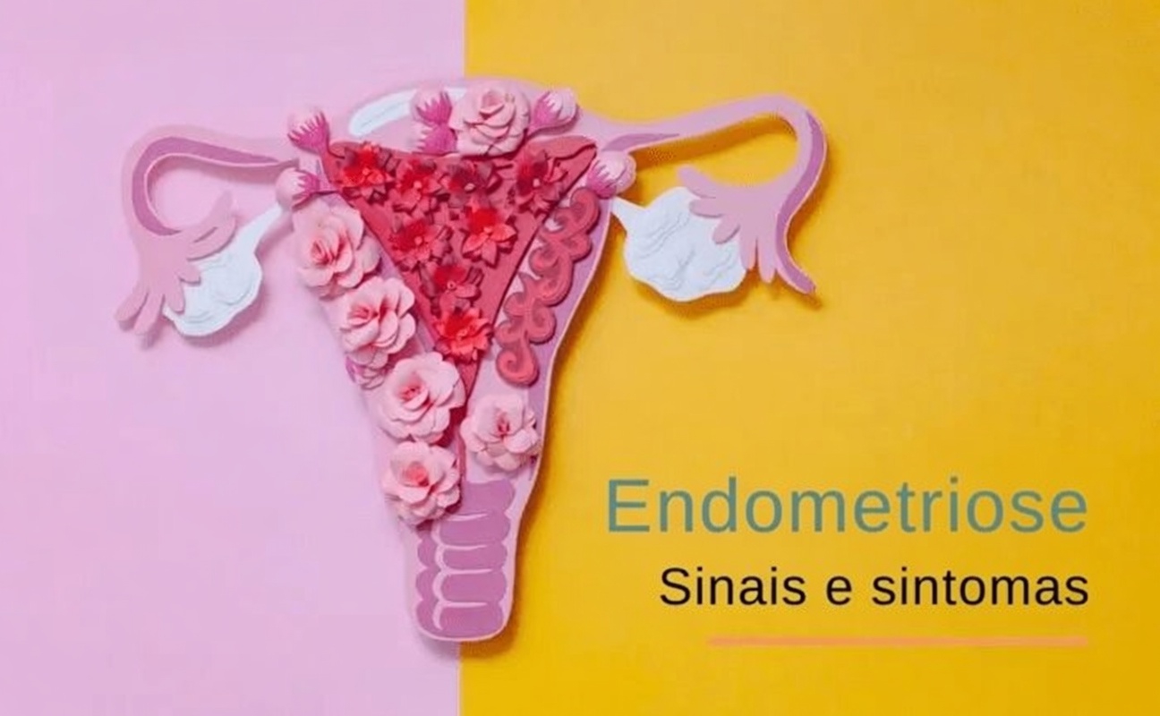 O Que Toda Mulher Deve Saber Sobre a Endometriose: Sintomas, Fatos e Dicas Práticas para o Dia a Dia