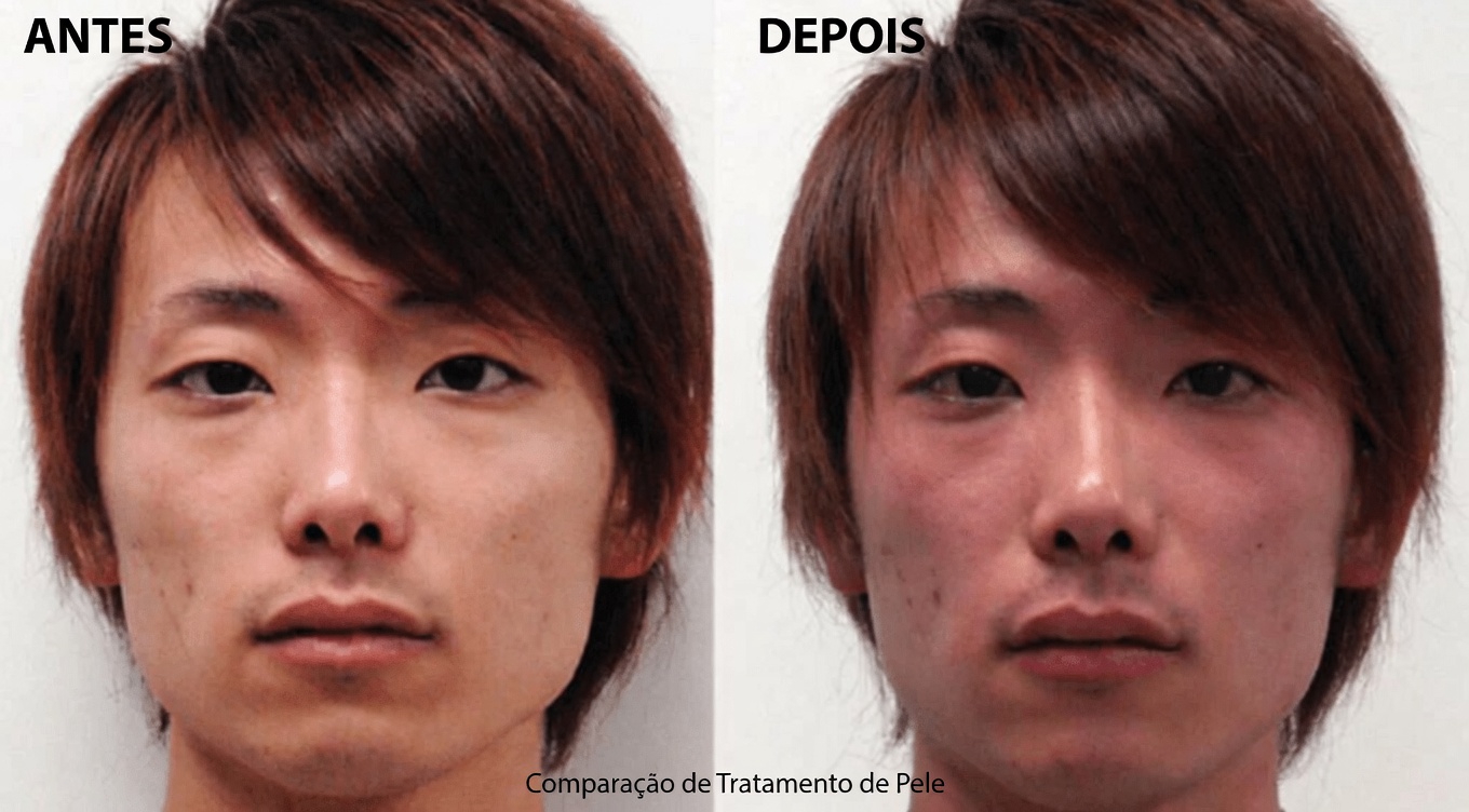 12 efeitos colaterais da amlodipina que você precisa conhecer – um guia completo para usuários