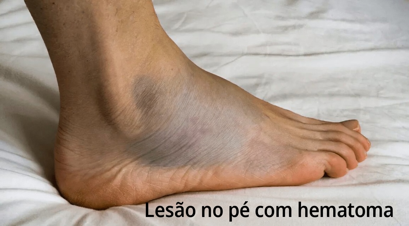 10 efeitos colaterais comuns da amlodipina que você deve conhecer se toma este popular medicamento para pressão arterial