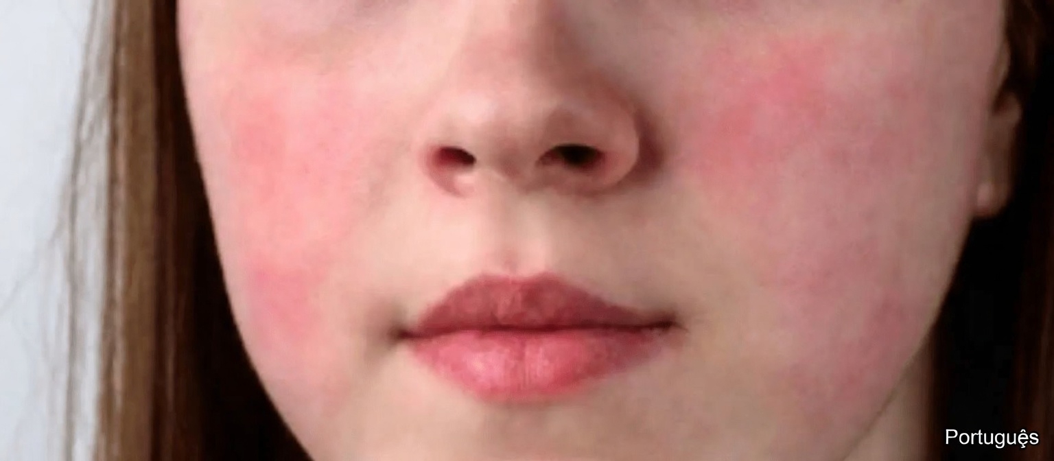 12 efeitos colaterais comuns da amlodipina que você deve conhecer e como controlá-los com segurança