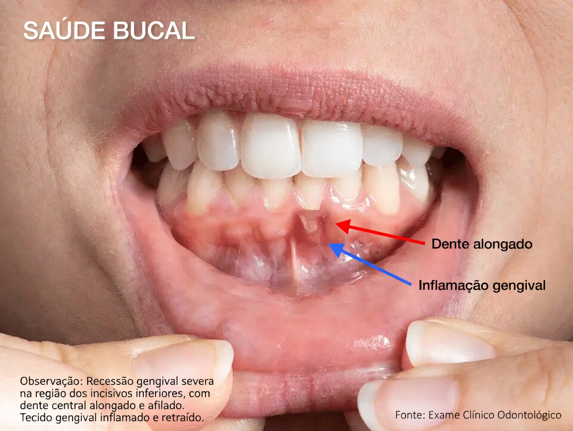 12 efeitos colaterais comuns da amlodipina que você deve conhecer e como controlá-los com segurança