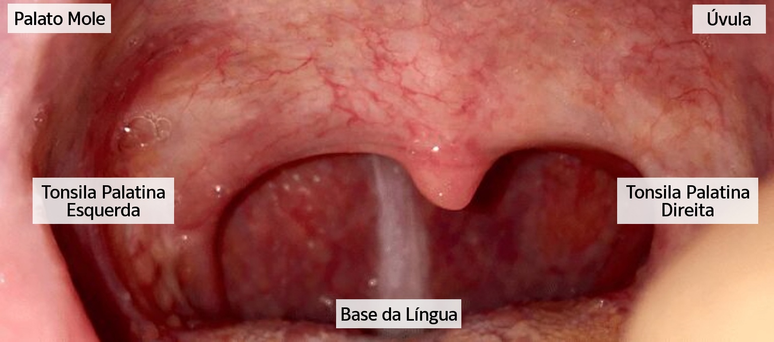 Por que você tem catarro persistente na garganta? O hábito oculto que está piorando isso sem você perceber