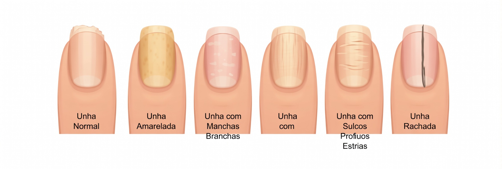 Por que suas unhas podem oferecer pistas sobre o que está acontecendo por dentro