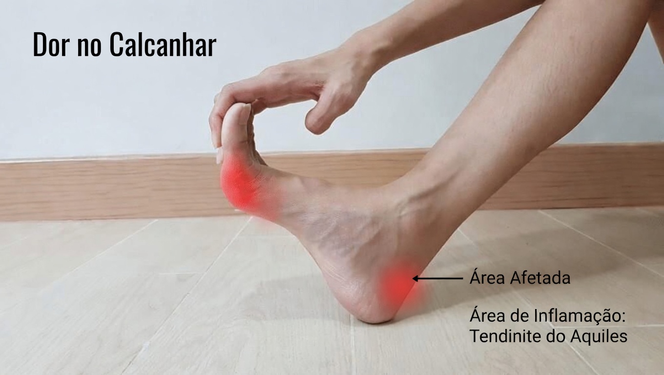8 Sinais Estranhos de que Seu Corpo Está Implorando por Vitamina B12 e Você Deve Reconhecer Imediatamente