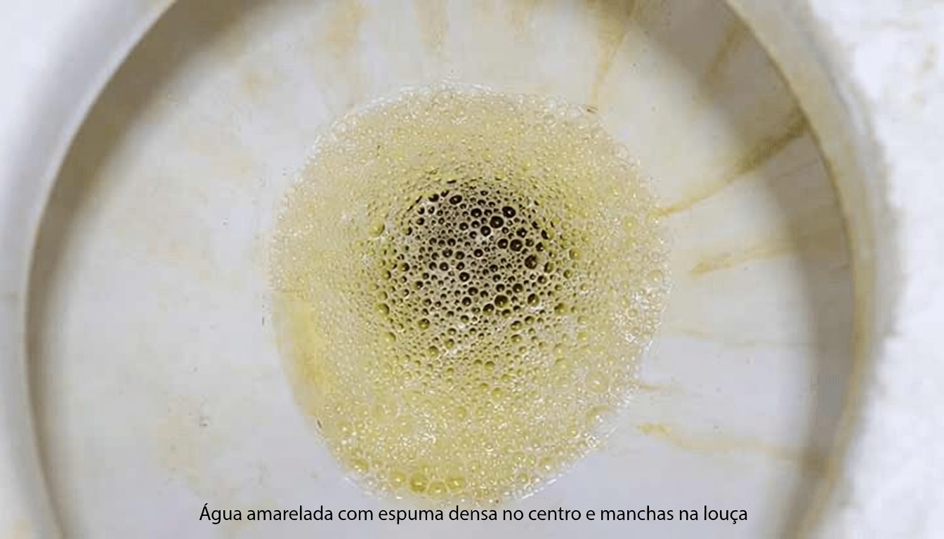 Descubra 7 Sinais Estranhos de Que Seus Rins Podem Estar Pedindo Ajuda em Silêncio Que a Maioria das Pessoas Ignora