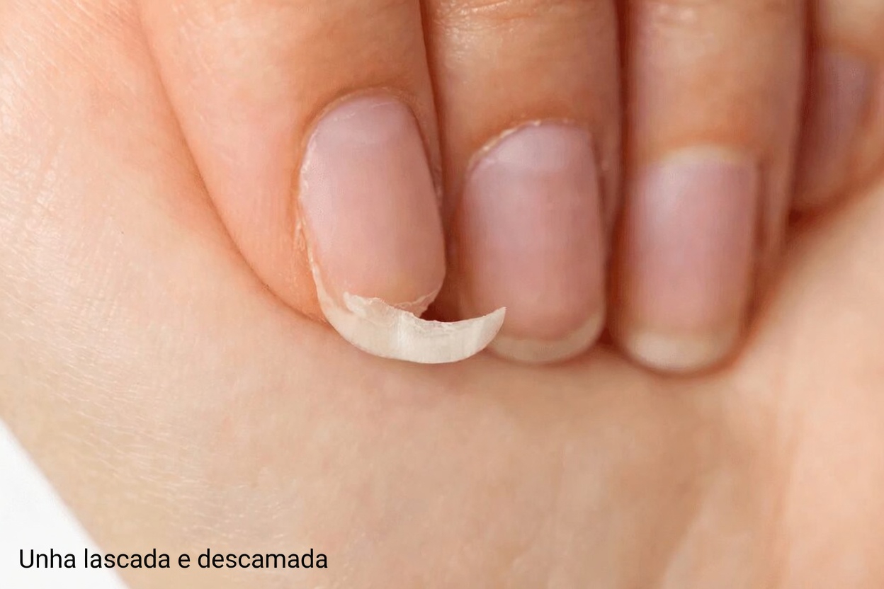 Suas unhas estão sempre lascando ou quebrando? Veja o que seu corpo pode estar tentando lhe dizer
