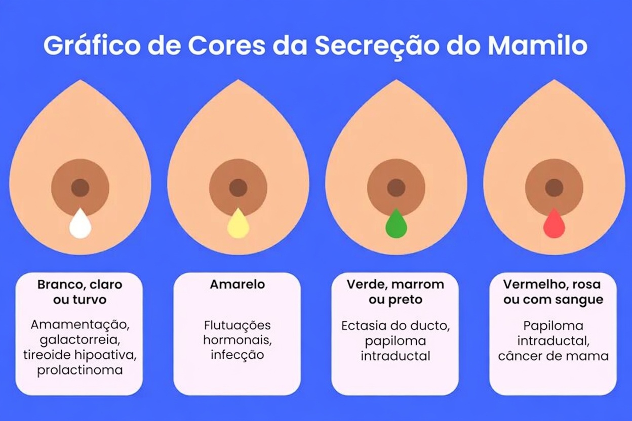 10 sinais de alerta do câncer de mama que toda mulher deve conhecer e nunca ignorar