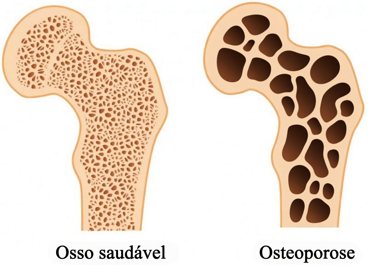 Você está tomando Prilosec diariamente? Aqui estão 5 fatos importantes sobre o uso a longo prazo que todos precisam saber