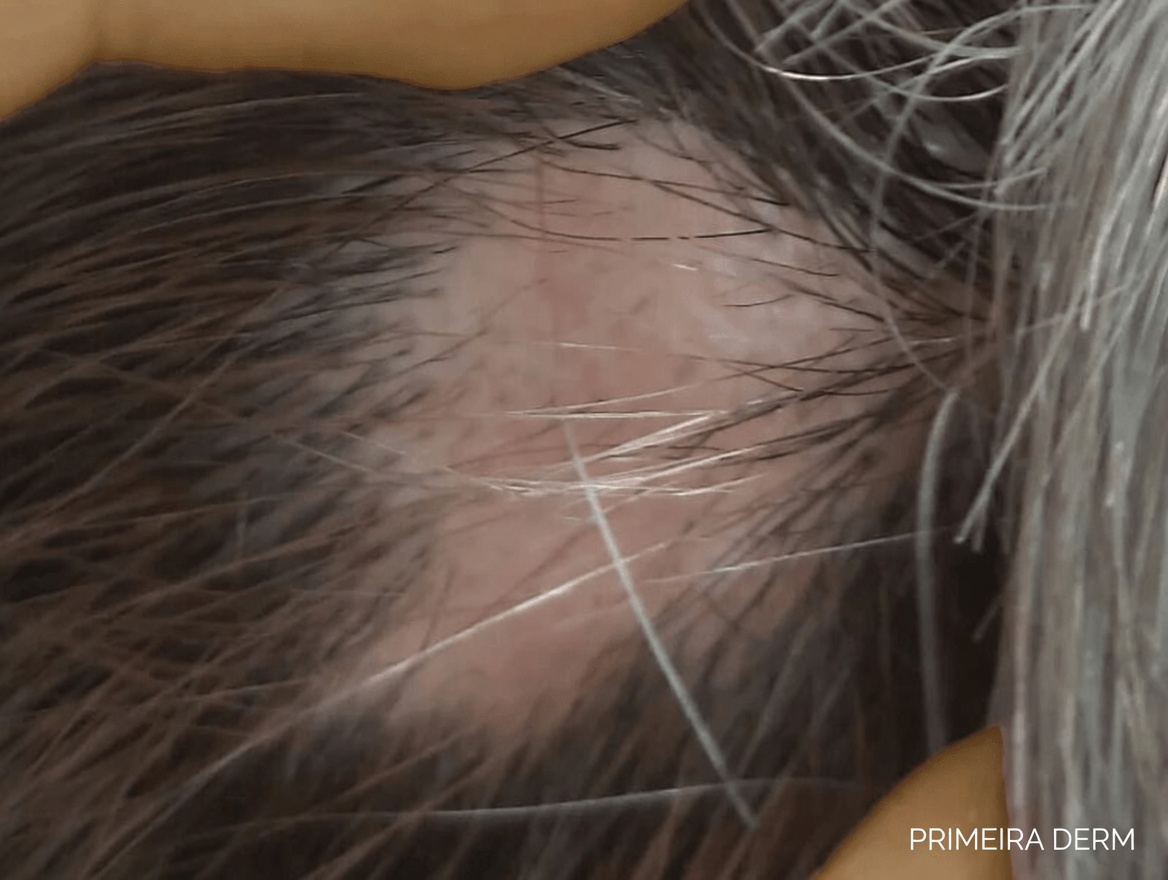 Aqui estão 8 sinais estranhos de que seu corpo está implorando por vitamina B12 que a maioria das pessoas ignora completamente