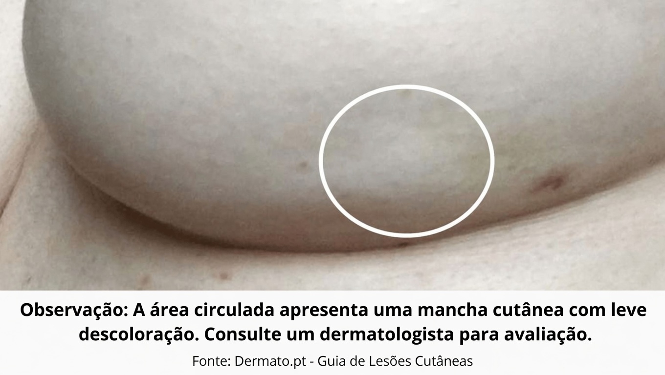 14 Sinais Visíveis de Câncer que a Maioria das Mulheres Ignora e o que Toda Mulher Deve Saber Sobre Eles