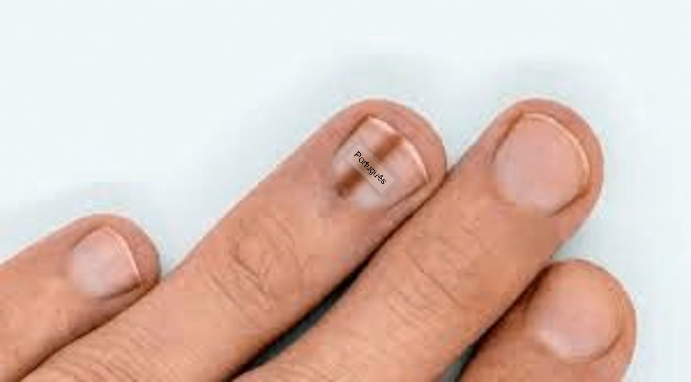 14 sinais visíveis de câncer que a maioria das mulheres ignora, mas deveria conhecer