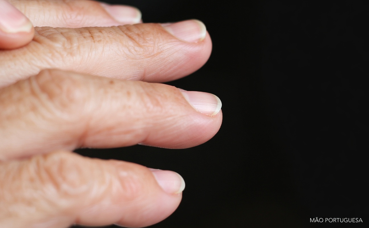 Você está percebendo estas 5 mudanças nas unhas que podem ser sinais importantes para a sua saúde?