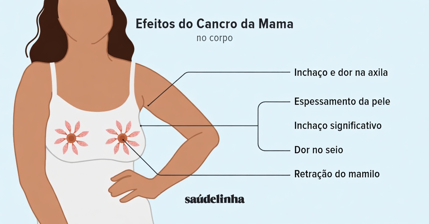 Quais são os 10 sinais de alerta do câncer de mama que as mulheres devem reconhecer para uma melhor conscientização?