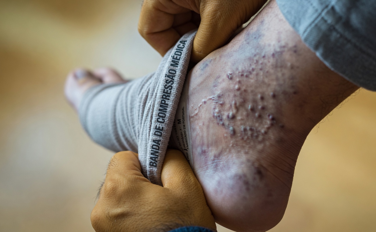 10 Formas Naturais de Favorecer uma Circulação Sanguínea Saudável e Ajudar a Aliviar o Desconforto das Varizes