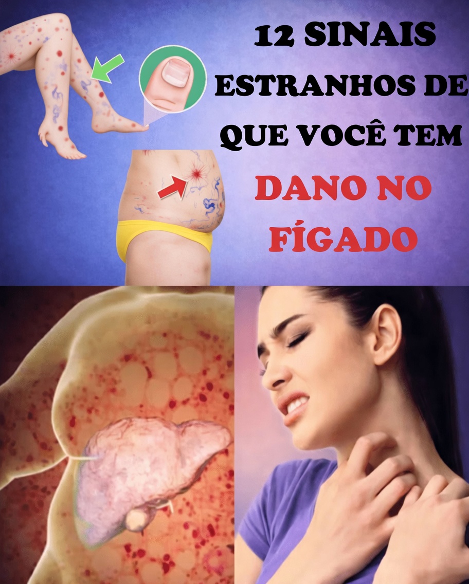 12 Sinais de Alerta Incomuns de que Seu Fígado Pode Estar Sofrendo (E Por Que Você Não Deve Ignorá-los)