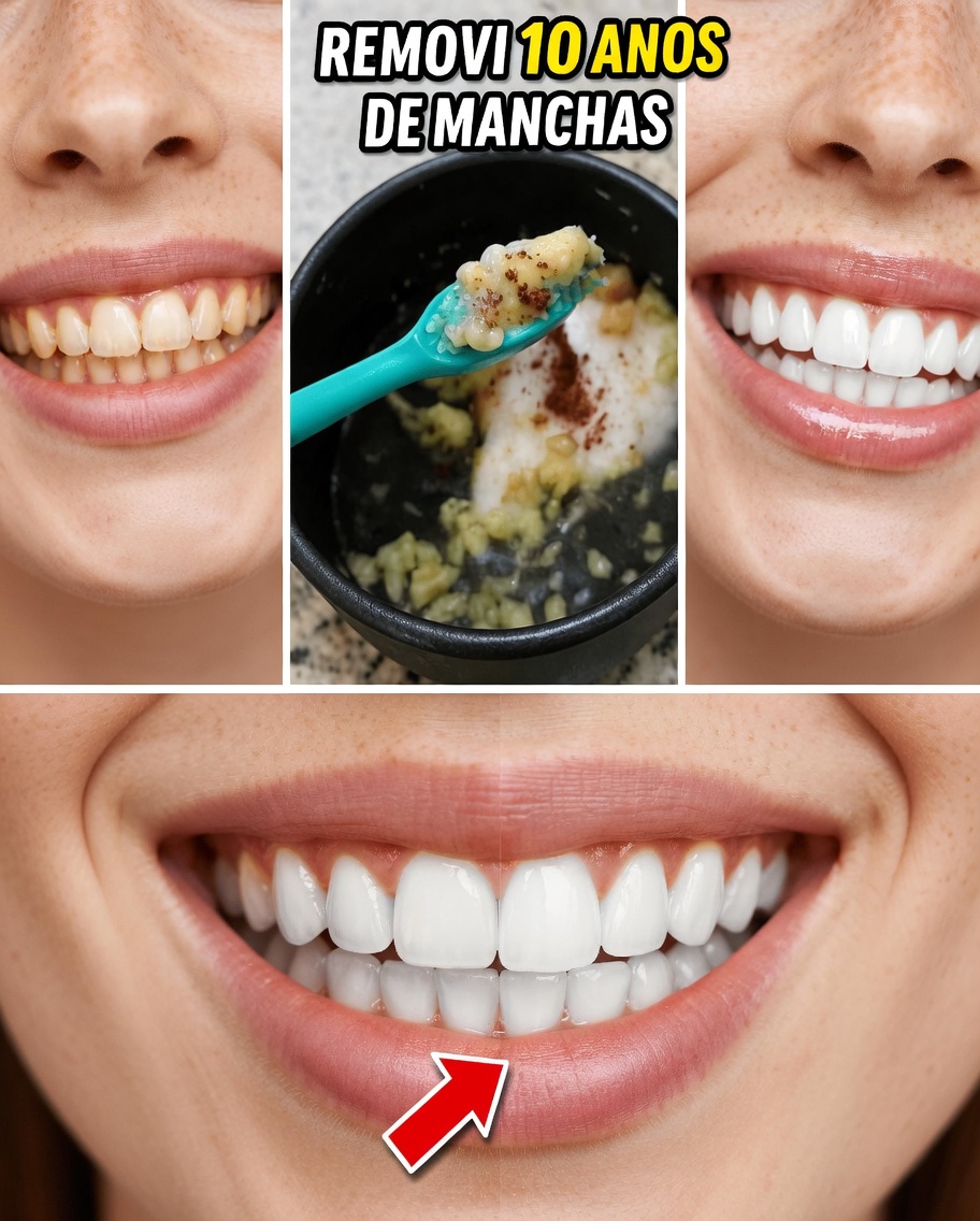 Experimente este truque fácil de 2 minutos para clarear os dentes com alho usando ingredientes da cozinha para um sorriso mais brilhante