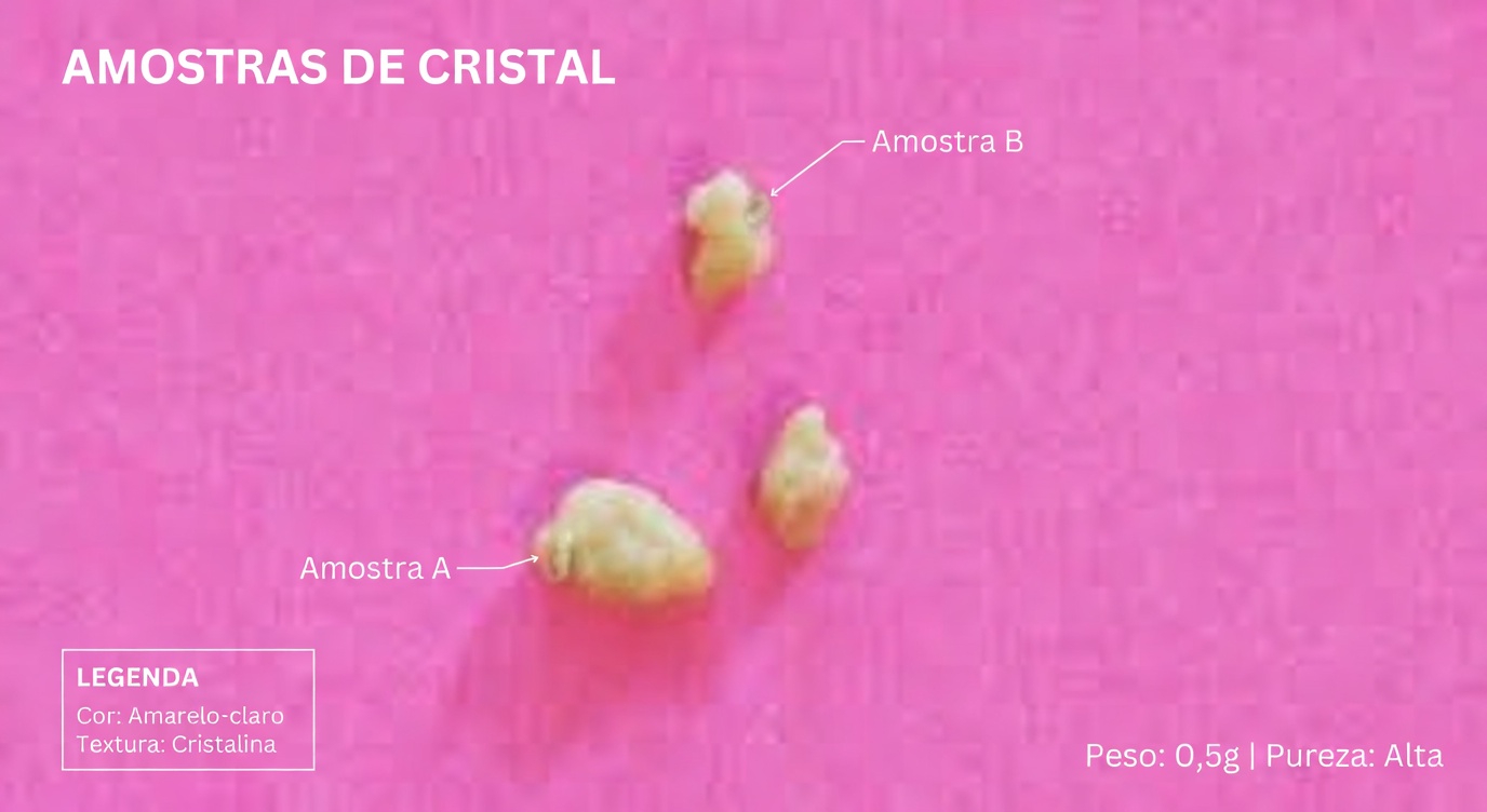 O Que São Aquelas Pedras Brancas na Sua Garganta que Causam Mau Hálito e Desconforto?