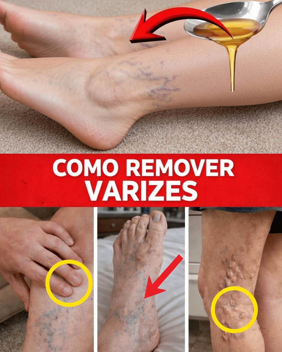 10 Maneiras Naturais de Promover Veias Mais Saudáveis e Melhorar a Circulação Sanguínea para Varizes