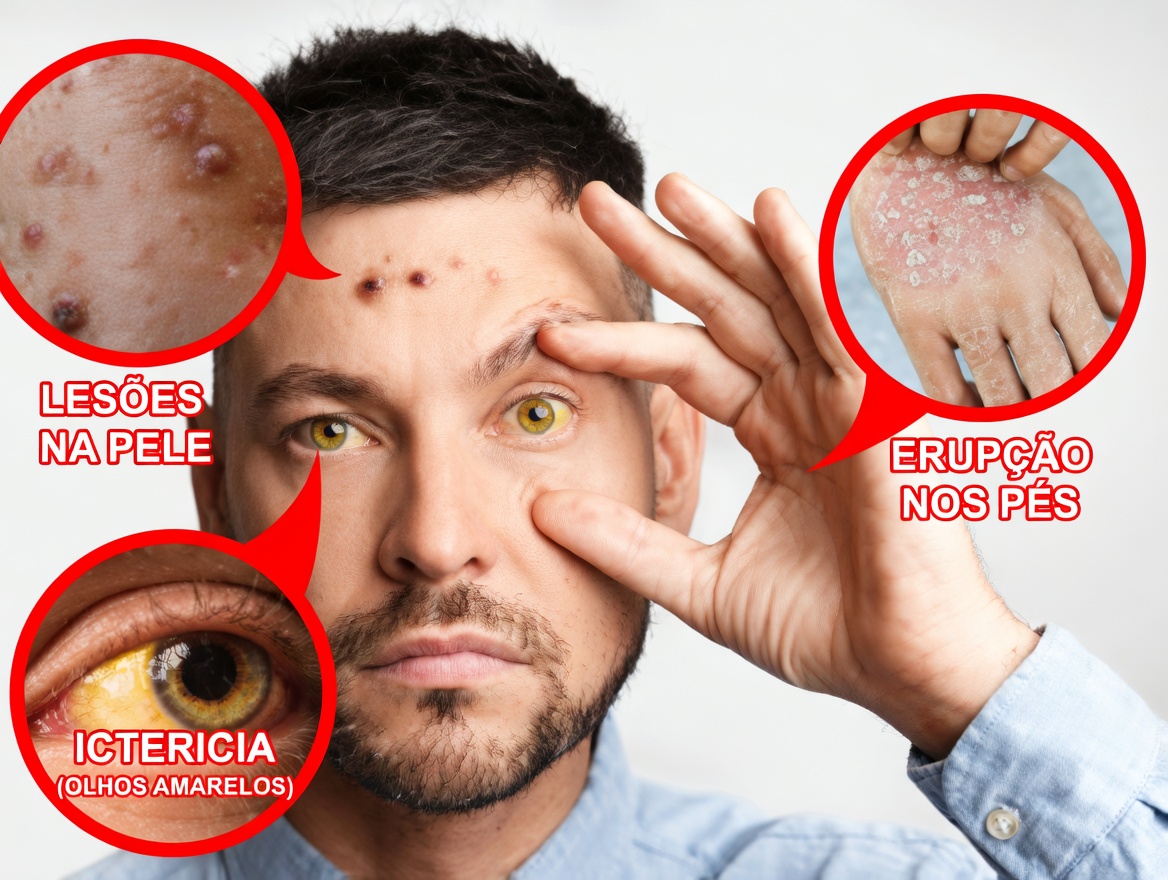 Este Sintoma no Fígado que Você Nunca Deve Ignorar por Mais de 5 Dias (E o que Ele Realmente Significa)