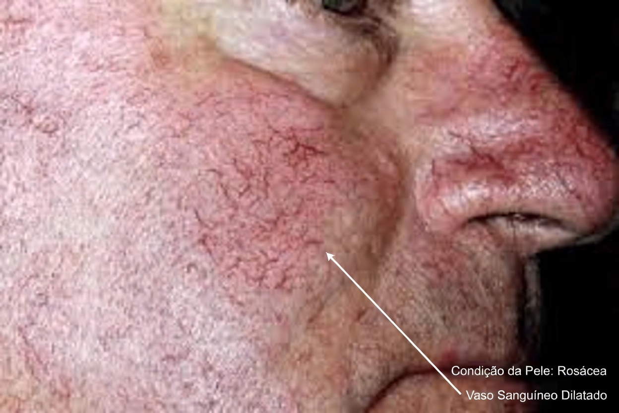 Seu Fígado Está Enviando Sinais de Alerta? 7 Indicadores que Você Não Deve Ignorar (e o que Realmente Ajuda)