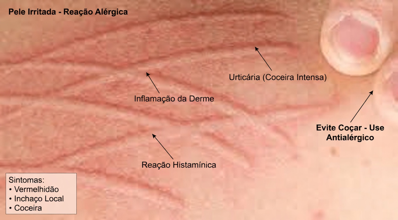 Coceira em 9 áreas: um sinal de alerta de tumores malignos, a número 7 é a mais comum