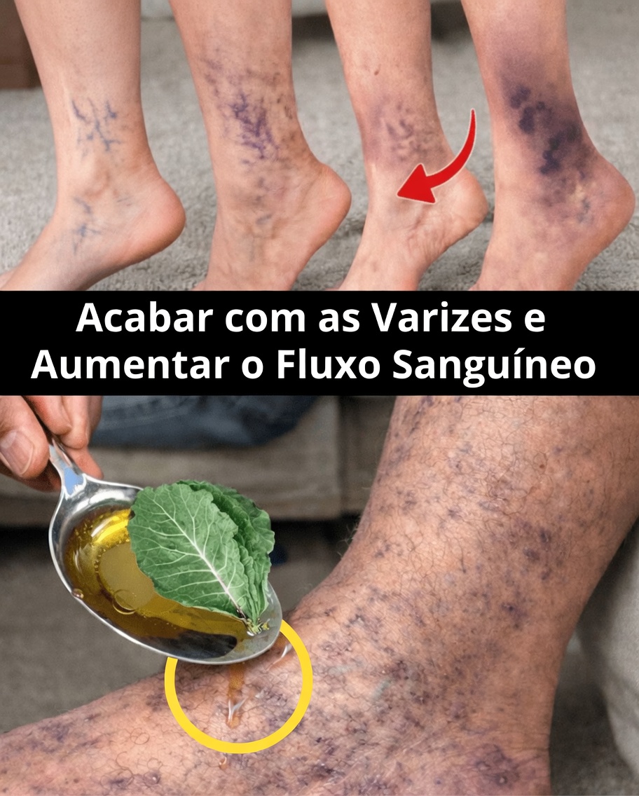 10 Hábitos Naturais do Dia a Dia que Podem Ajudar a Melhorar a Circulação Sanguínea e Apoiar Veias das Pernas Mais Saudáveis