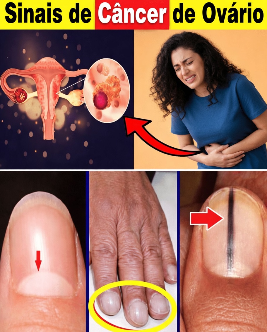 Mulheres: Não Ignorem Estes 14 Sinais Ocultos de Câncer Que Podem Salvar Vidas