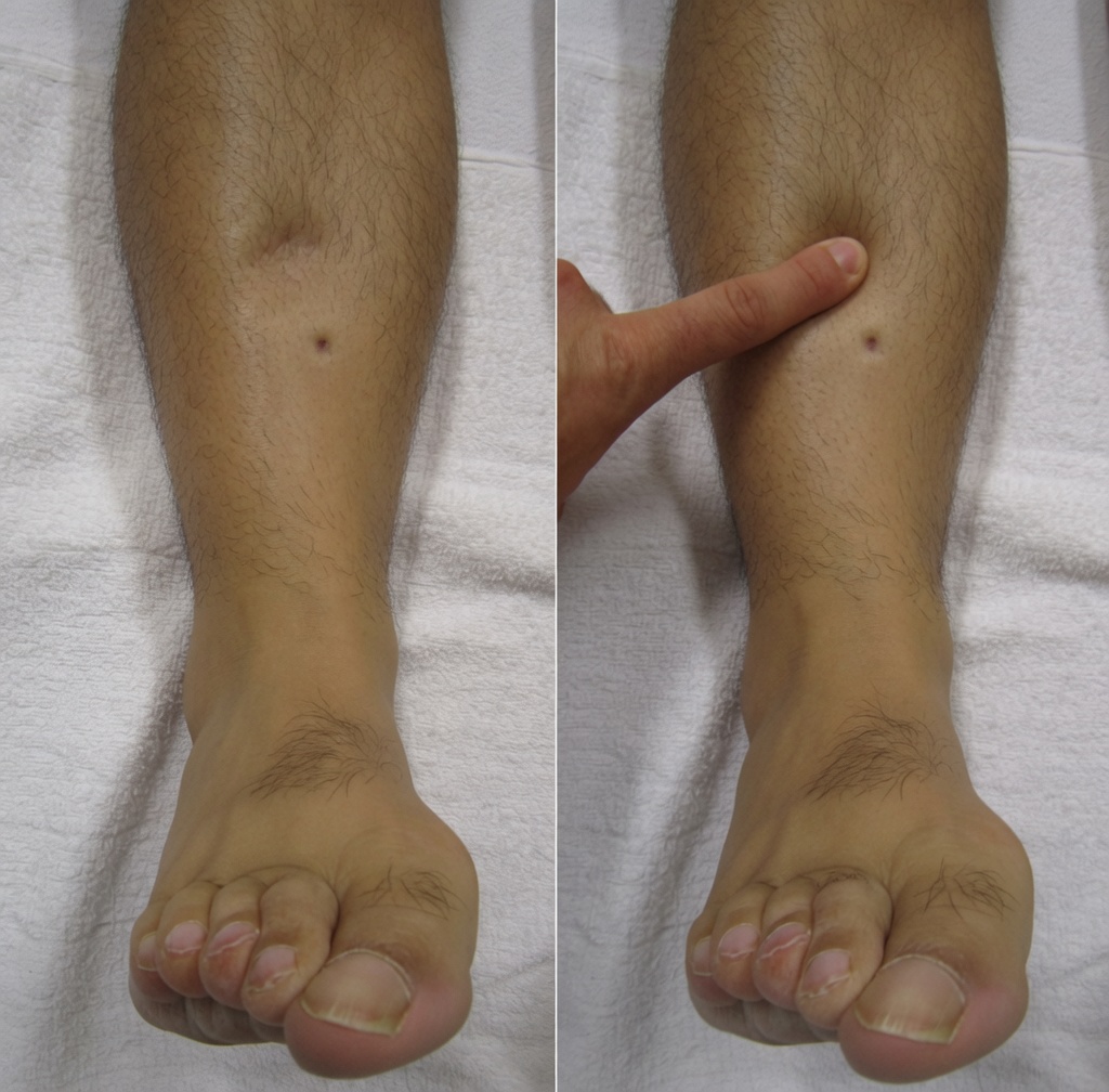 Descubra 12 efeitos colaterais da amlodipina que você deve conhecer e dicas práticas para lidar com eles