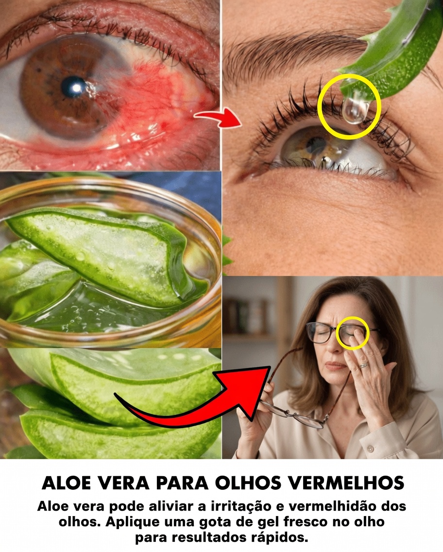 Aloe Vera para o Conforto Diário dos Olhos: Explorando Maneiras Naturais de Aliviar Vermelhidão, Ressecamento e Irritação em Casa