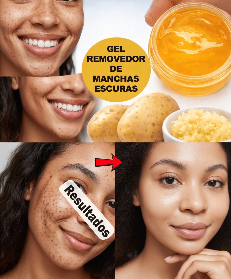 Desvende o Segredo da Cozinha: Como Batatas e Gengibre Podem Ajudar a Deixar a Pele Mais Iluminada e Uniforme