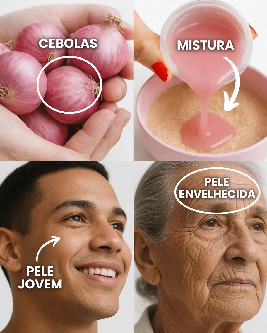 Cebola roxa para o rosto: o truque natural de cozinha que milhares estão explorando para uma aparência de pele radiante e com tom uniforme