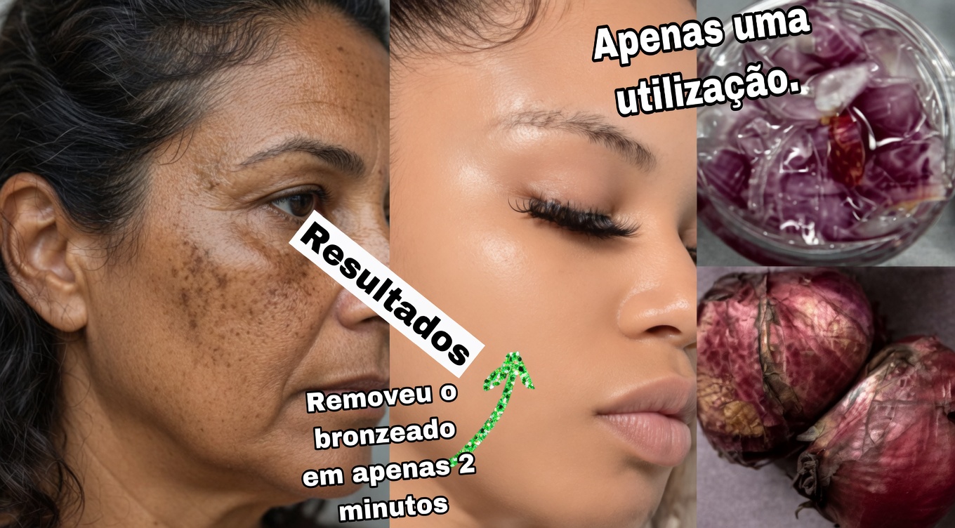Cebola roxa para o rosto: o truque natural de cozinha que milhares estão explorando para uma aparência de pele radiante e com tom uniforme