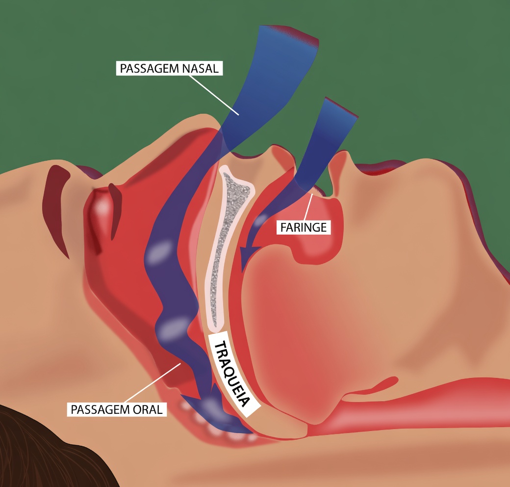 Se você baba enquanto dorme, deve ser avaliado para estas 8 condições