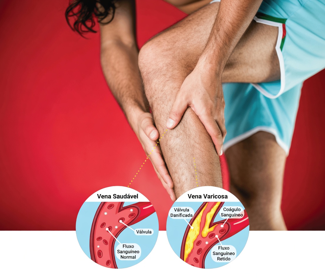 Médicos alertam: 10 sinais silenciosos de que as artérias das suas pernas estão entupidas