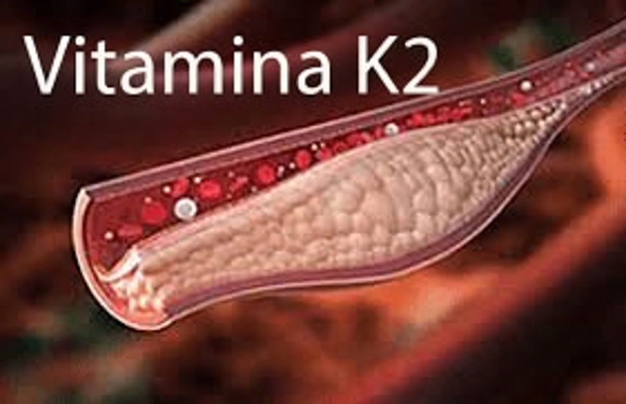 1 vitamina impede o acúmulo de cálcio nas artérias e no coração