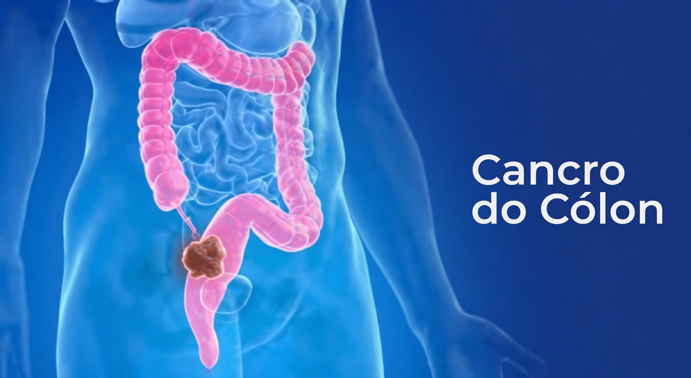 7 Sinais de Alerta Sutis do Câncer de Cólon que Você Nunca Deve Ignorar e Como a Consciência Pode te Empoderar