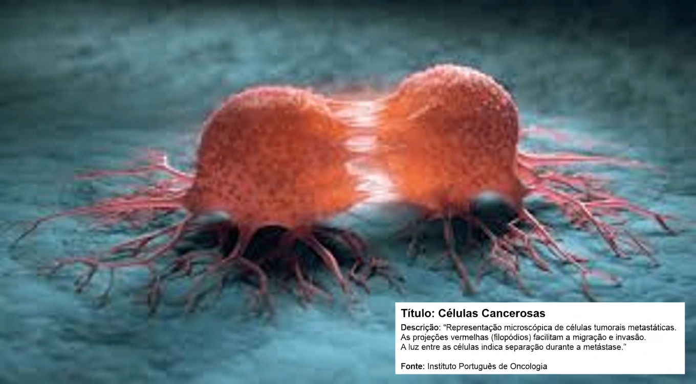 5 PIORES alimentos que podem alimentar células cancerígenas: o que a ciência sugere que você deve limitar