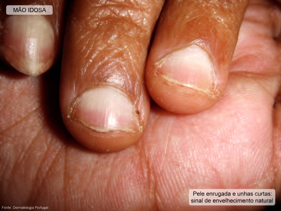 17 Sinais Perigosos de Doença Renal Visíveis no Seu Corpo – Identifique-os Antes que Seja Tarde Demais