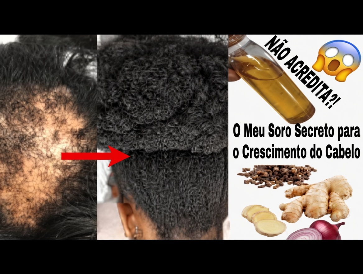 Cravo, Alecrim e Gengibre: o simples tônico capilar de 3 ingredientes que está chocando as pessoas (melhor do que a Aloe Vera?)