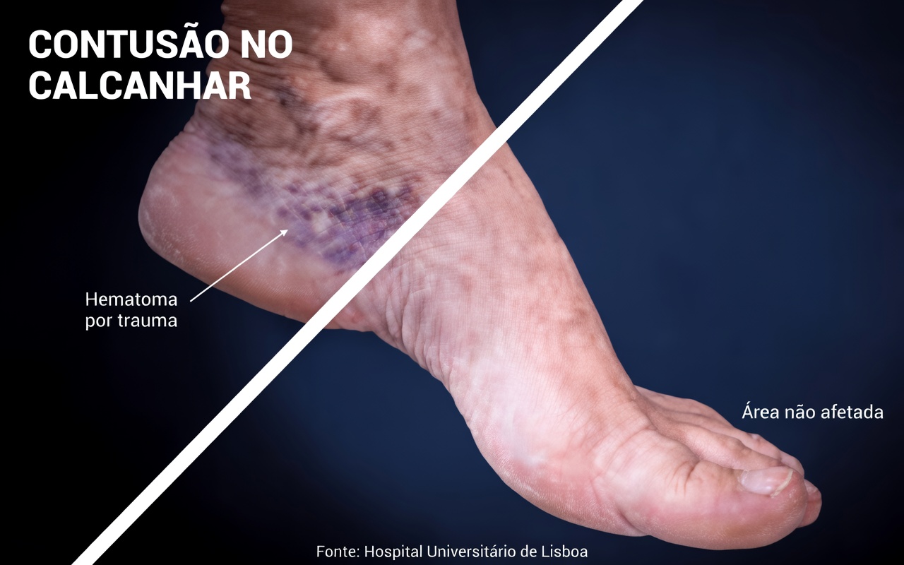 Mulheres com mais de 60 anos: 10 sinais de alerta nas pernas que você não deve ignorar – atenção ao nº 7!