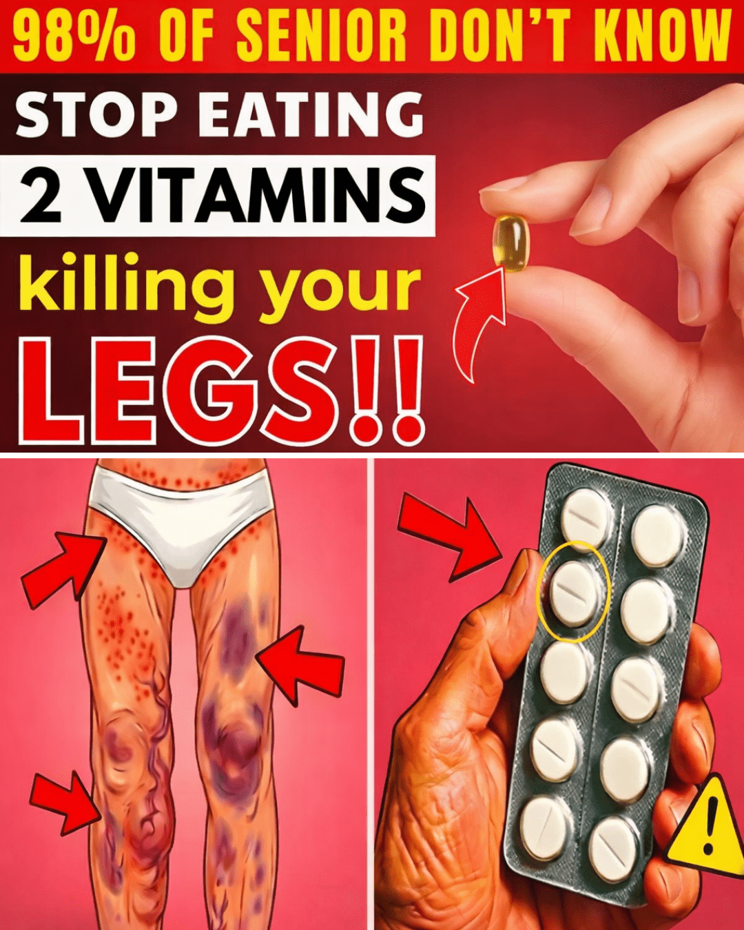 IDOSOS: As 2 piores vitaminas que podem enfraquecer suas pernas após os 60 (e os alimentos a evitar)