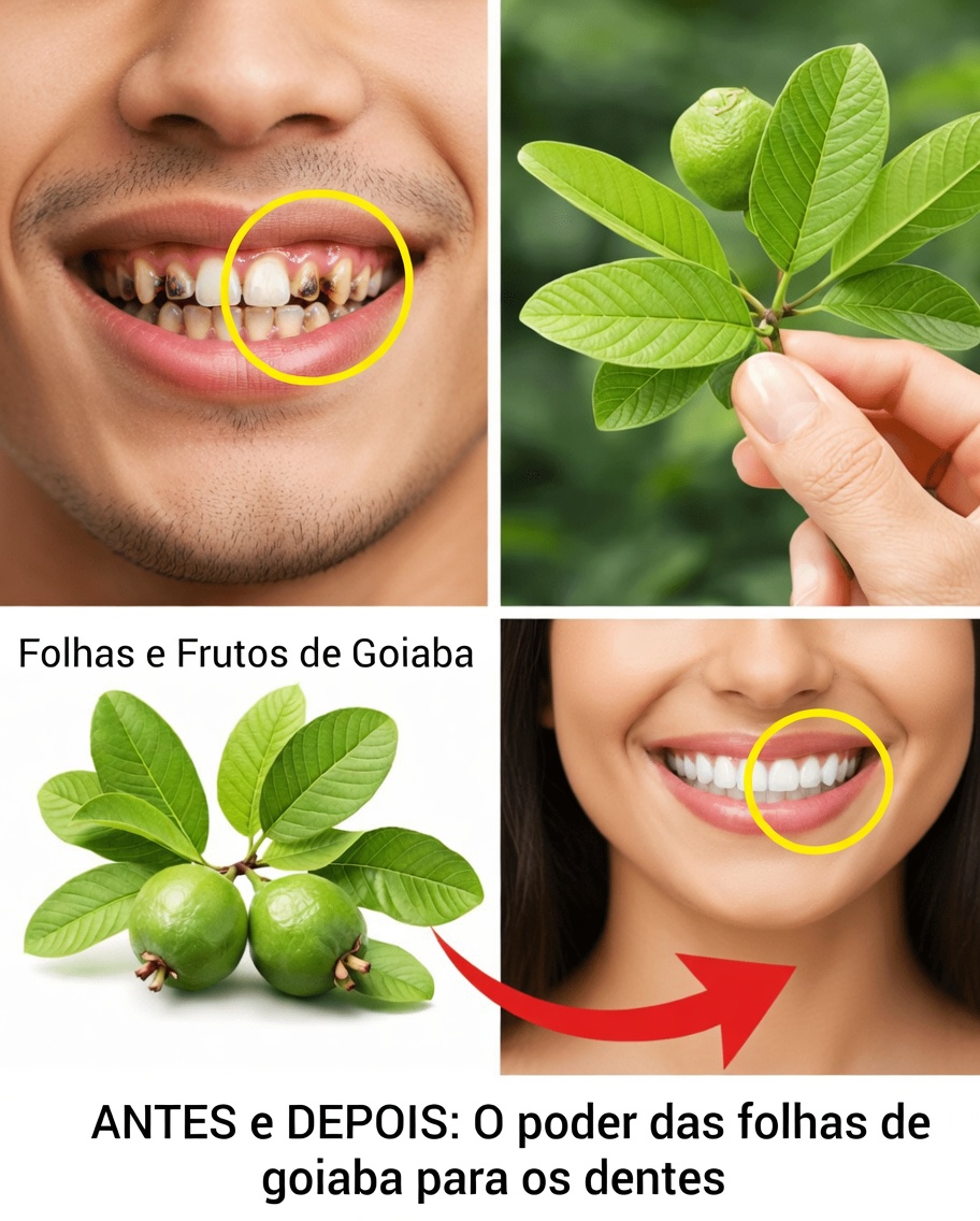 Desvende o Segredo da Natureza para o Seu Sorriso: Top 3 Remédios com Folhas de Goiabeira para Cuidar da Saúde Bucal Diária