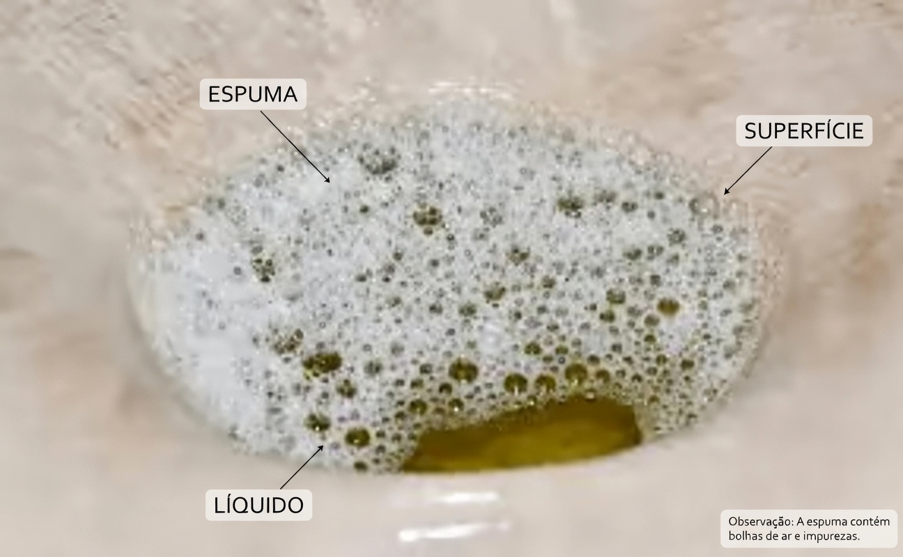 Preocupado com sintomas de proteinúria como fadiga e urina espumosa? 6 estratégias comprovadas pela ciência para apoiar a saúde dos seus rins