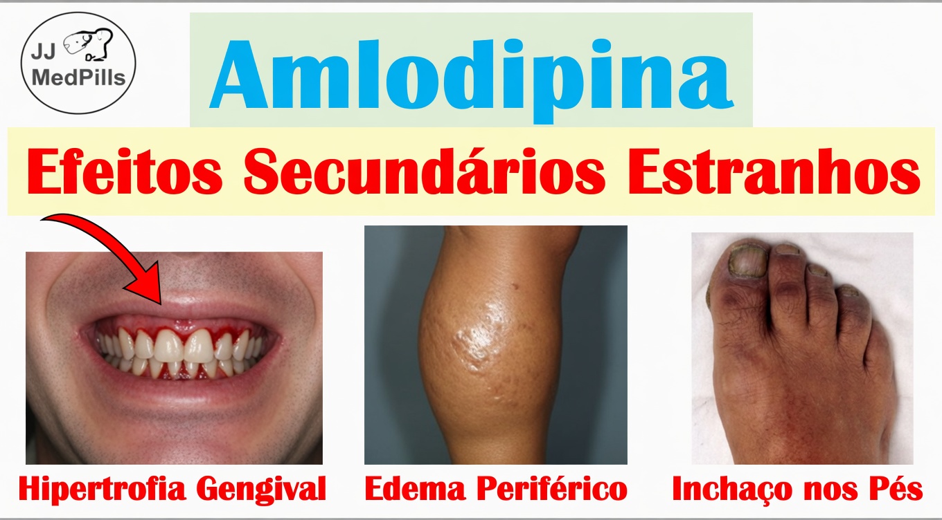 Efeitos Colaterais da Amlodipina: O Que Eles Realmente Significam e Passos Simples que Podem Ajudar a Reduzir o Desconforto