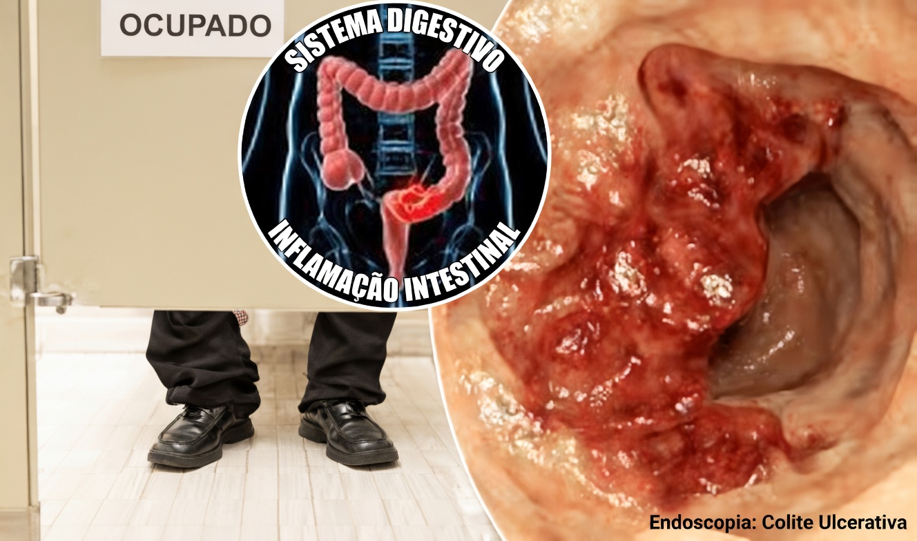 10 sinais silenciosos de câncer de cólon que você provavelmente está ignorando (até médicos às vezes deixam passar o #3)