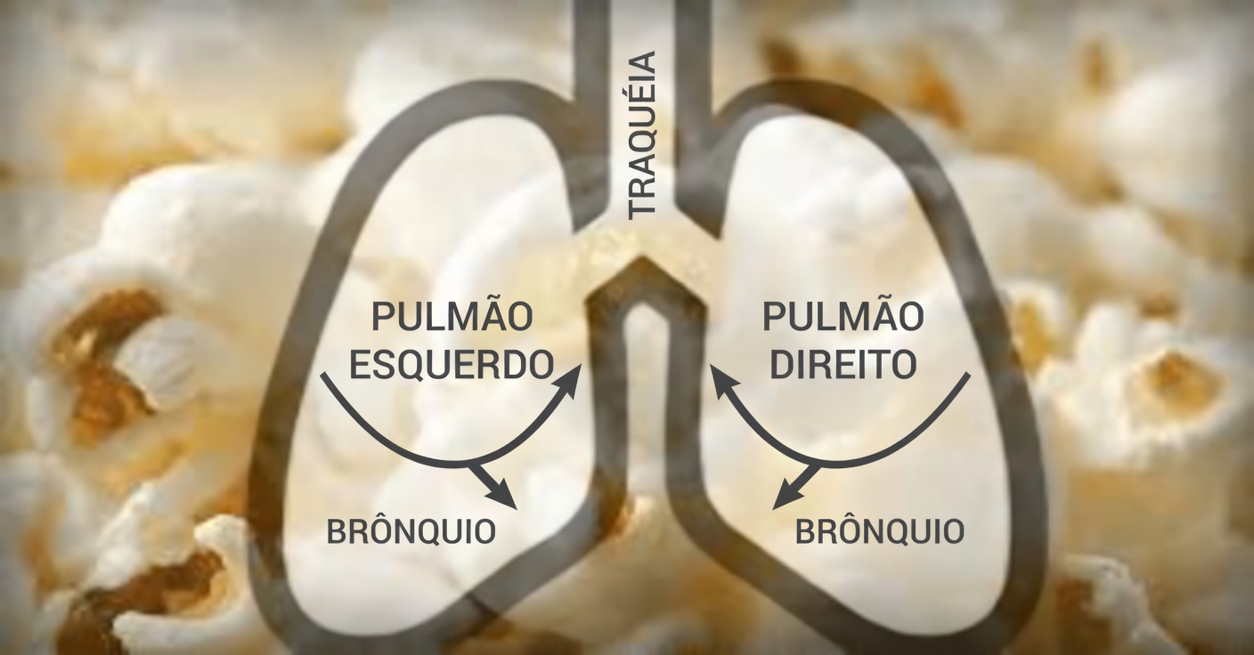 Alerta Urgente: “Pulmão de Pipoca” Ligado ao Vaping Causa Danos Duradouros, Alertam Especialistas